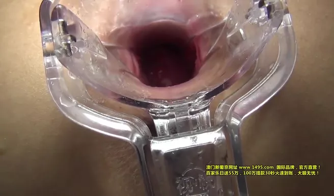 Азиатская медсестричка балует пациента еблей в палате и без рецепта, пока все спят